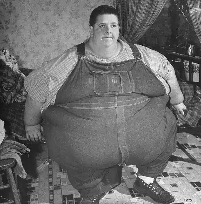 Her ses verdens tykkeste mand som hedder Jon Brower Minnoch. Han vejede 635 kg.